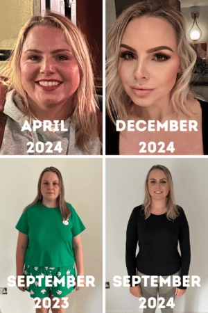 Before and after weight loss photos